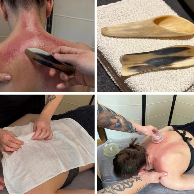 GUASHA TERAPEUTYCZNA / NATUROTERAPIA PLECÓW